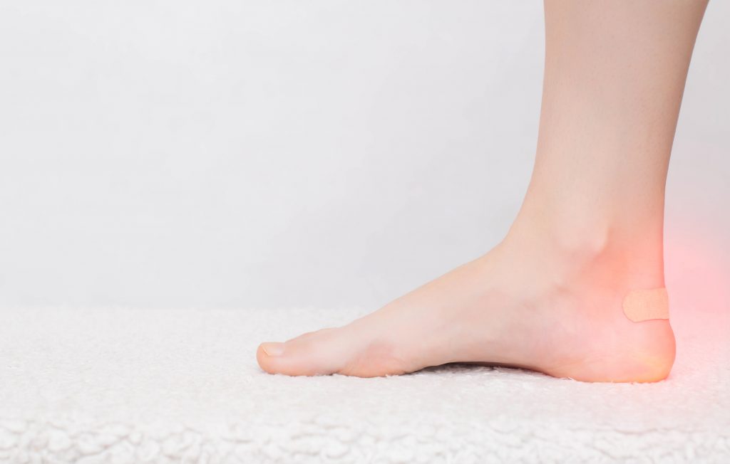 how to stop shoes rubbing the back of your ankle